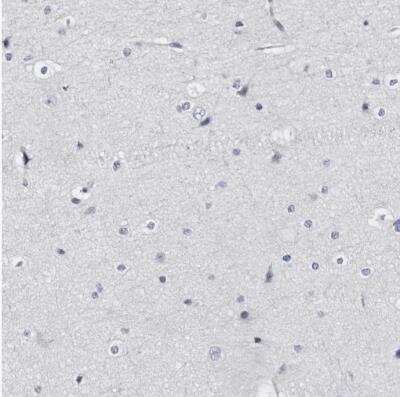 Immunohistochemistry-Paraffin: LAD1 Antibody [NBP1-85945]