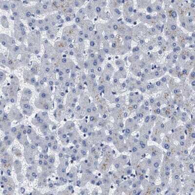 Immunohistochemistry-Paraffin: LAD1 Antibody [NBP1-86126]