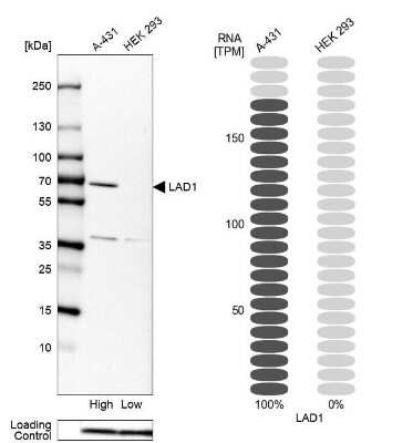 Western Blot: LAD1 Antibody [NBP1-86126]