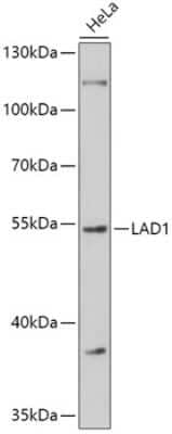 Western Blot: LAD1 AntibodyAzide and BSA Free [NBP3-05014]