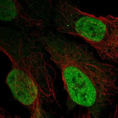 Immunocytochemistry/ Immunofluorescence: LAF4 Antibody [NBP2-54913]