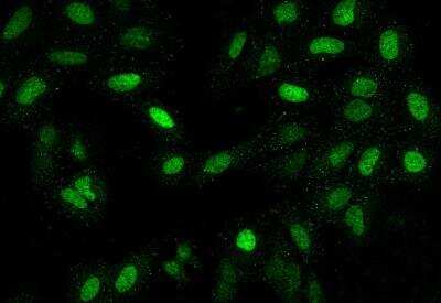 Immunocytochemistry/ Immunofluorescence: LAF4 Antibody [NBP3-06186]