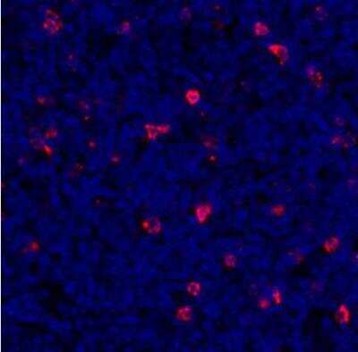 Immunohistochemistry-Paraffin: LAG-3 Antibody (BLR027F) [NBP2-76402]