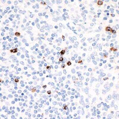 Immunohistochemistry-Paraffin: LAG-3 Antibody (BLR027F) [NBP2-76402]