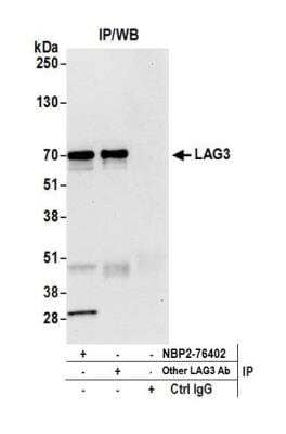 Immunoprecipitation: LAG-3 Antibody (BLR027F) [NBP2-76402]
