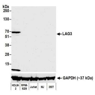 Western Blot: LAG-3 Antibody (BLR027F) [NBP2-76402]