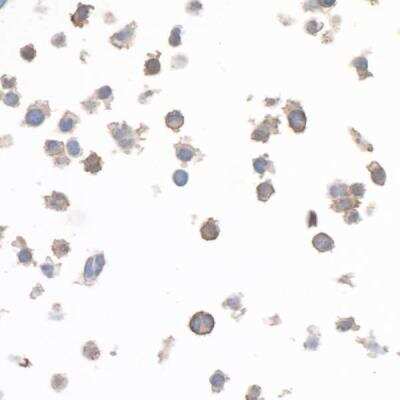 Immunocytochemistry: LAG-3 Antibody (BLR028F) [NBP2-76403]