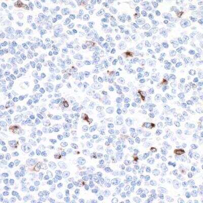 Immunohistochemistry-Paraffin: LAG-3 Antibody (BLR028F) [NBP2-76403]