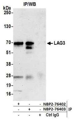 Immunoprecipitation: LAG-3 Antibody (BLR028F) [NBP2-76403]