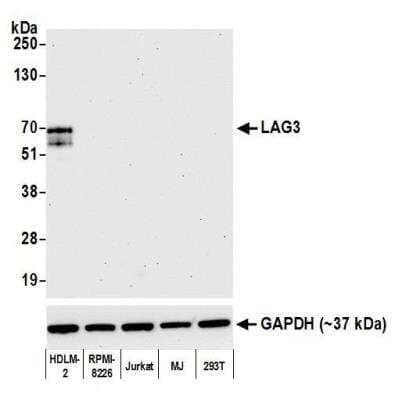 Western Blot: LAG-3 Antibody (BLR028F) [NBP2-76403]