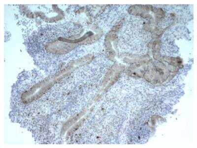 Immunohistochemistry-Paraffin: LAG-3 Antibody (L4-PL33) - Azide Free [NBP3-05777]