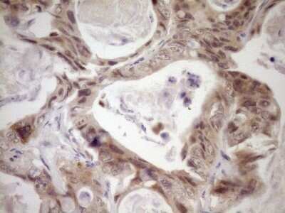 Immunohistochemistry: LAG-3 Antibody (OTI8F6) - Azide and BSA Free [NBP2-71112]