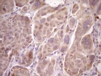 Immunohistochemistry: LAG-3 Antibody (OTI8F6) - Azide and BSA Free [NBP2-71112]