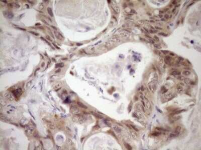 Immunohistochemistry: LAG-3 Antibody (OTI8F6) [NBP2-45581]