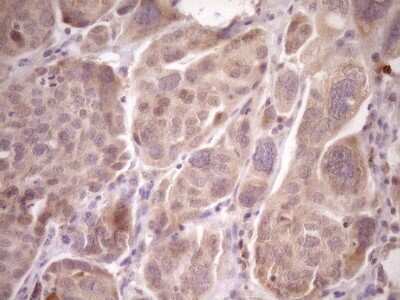Immunohistochemistry: LAG-3 Antibody (OTI8F6) [NBP2-45581]