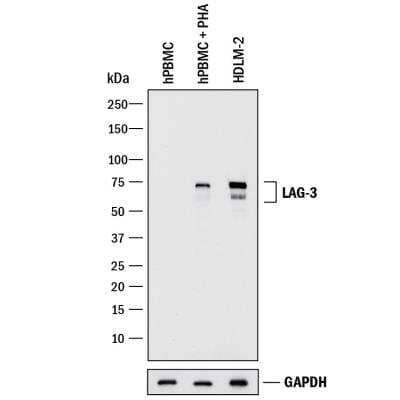Western Blot: LAG-3 Antibody Pack [NBP3-11743]