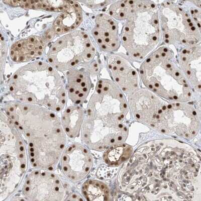 Immunohistochemistry-Paraffin: LAGE3 Antibody [NBP2-32715]