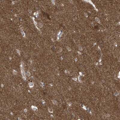 Immunohistochemistry-Paraffin: LAGE3 Antibody [NBP1-94092]