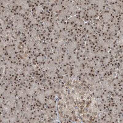 Immunohistochemistry-Paraffin: LAGE3 Antibody [NBP1-94092]