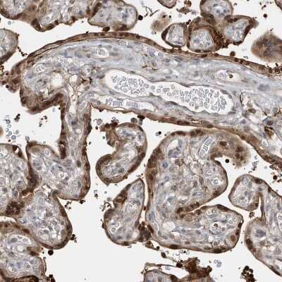 Immunohistochemistry-Paraffin: LAGE3 Antibody [NBP1-94092]
