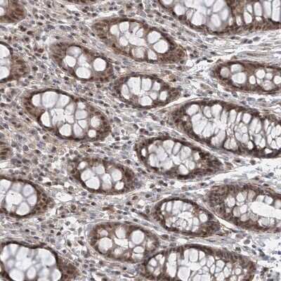 Immunohistochemistry-Paraffin: LAGE3 Antibody [NBP1-94092]