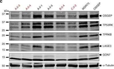 Western Blot: LAGE3 Antibody [NBP2-32715]