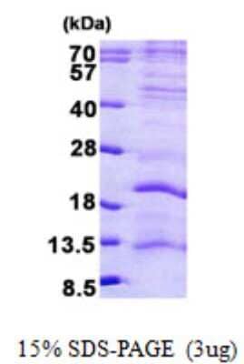 SDS-PAGE: Recombinant Human LAGE3 His Protein [NBP2-23178]