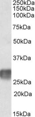 Western Blot: LAIR1 Antibody [NBP1-52010]