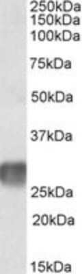 Western Blot: LAIR1 Antibody [NBP1-68845]