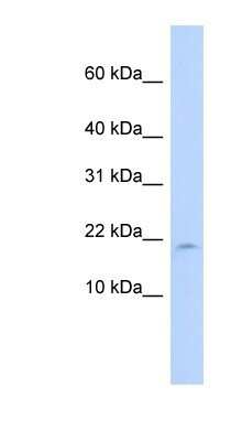 Western Blot: LAIR2 Antibody [NBP1-80500]