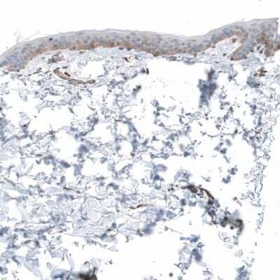 Immunohistochemistry-Paraffin: Laminin Antibody [NBP2-34181]