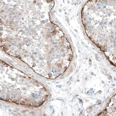 Immunohistochemistry-Paraffin: Laminin Antibody [NBP2-34181]