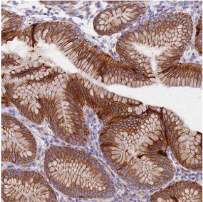 Immunohistochemistry-Paraffin: LAMB4 Antibody [NBP2-14789]