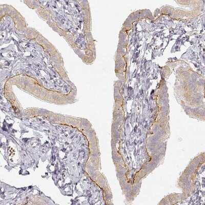 Immunohistochemistry-Paraffin: LAMC2 Antibody (CL2980) [NBP2-42388]