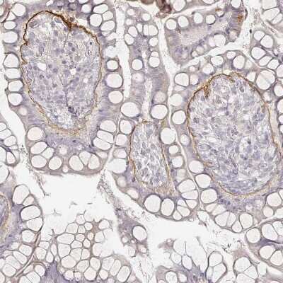 Immunohistochemistry-Paraffin: LAMC2 Antibody (CL2980) [NBP2-42388]