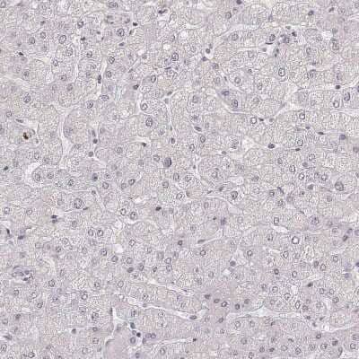 Immunohistochemistry-Paraffin: LAMC2 Antibody (CL2980) [NBP2-42388]