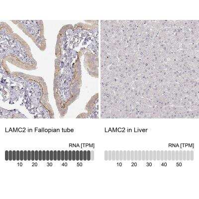 Immunohistochemistry-Paraffin: LAMC2 Antibody (CL2980) [NBP2-42388]