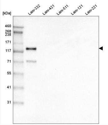 Western Blot: LAMC2 Antibody (CL2980) [NBP2-42388]