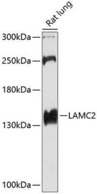 Western Blot: LAMC2 AntibodyAzide and BSA Free [NBP3-05167]