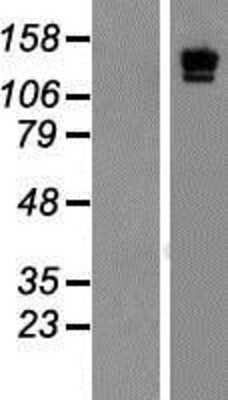 Western Blot: LAMC2 Overexpression Lysate [NBP2-06766]