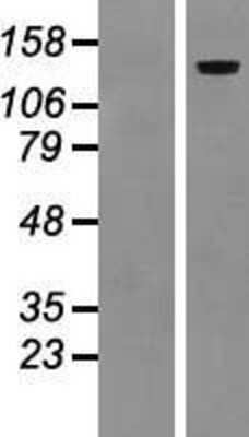 Western Blot: LAMC2 Overexpression Lysate [NBP2-07734]