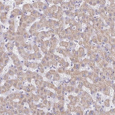 Immunohistochemistry: LAMC3 Antibody [NBP2-33895]