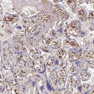 Immunohistochemistry-Paraffin: LAMC3 Antibody [NBP2-33895]
