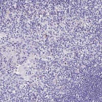 Immunohistochemistry-Paraffin: LAMC3 Antibody [NBP2-33895]