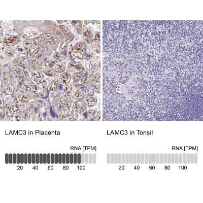 Immunohistochemistry-Paraffin: LAMC3 Antibody [NBP2-33895]