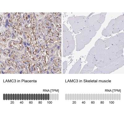Immunohistochemistry-Paraffin: LAMC3 Antibody [NBP2-33895]