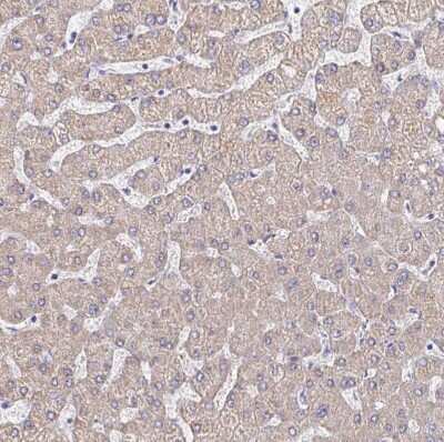 Immunohistochemistry-Paraffin: LAMC3 Antibody [NBP2-33895]