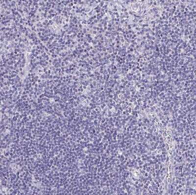 Immunohistochemistry-Paraffin: LAMC3 Antibody [NBP2-33895]