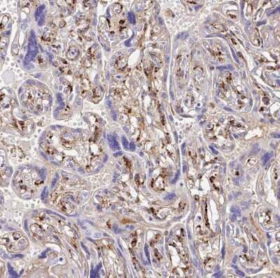 Immunohistochemistry-Paraffin: LAMC3 Antibody [NBP2-33895]