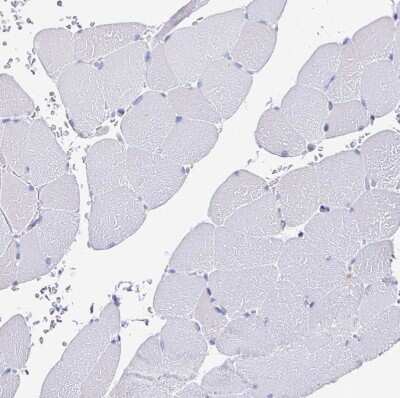 Immunohistochemistry-Paraffin: LAMC3 Antibody [NBP2-33895]